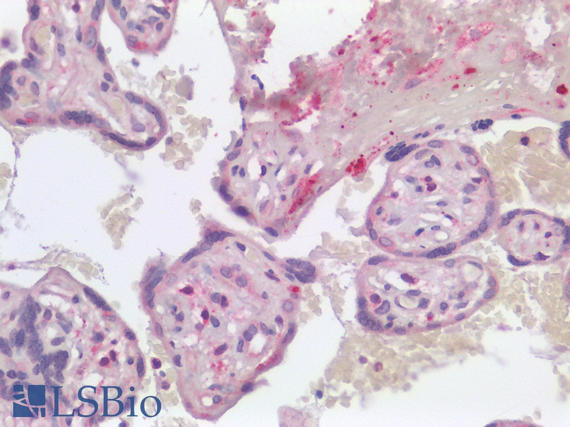 IHC-plus™ Polyclonal Rabbit anti-Human CTSL / Cathepsin L Antibody (IHC)