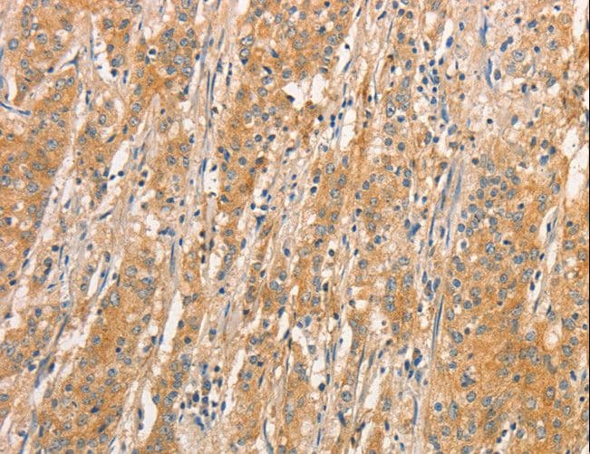 TLR3 Antibody