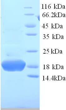 Human PHPT1 Protein (Recombinant His)