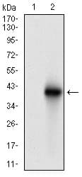 Monoclonal Mouse anti-Human BRCA1 Antibody (clone 6C6D2, aa229-335, IHC, WB)