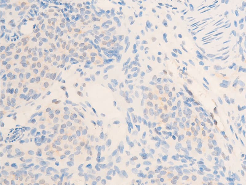 ERBB2 / HER2 Antibody (phospho-Tyr877)