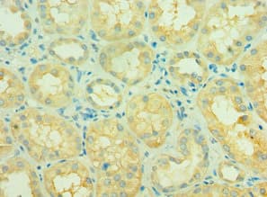 SIRT3 / Sirtuin 3 Antibody (aa20-130)