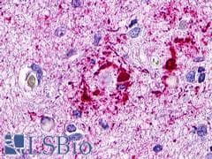 PathPlus™ ACKR4 / CCRL1 / CCR11 Antibody (Cytoplasmic Domain)