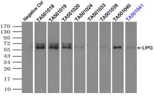 LIPG / Endothelial Lipase Antibody (clone OTI8F8)