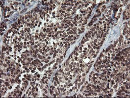 FAM164A / CGI-62 Antibody (clone OTI4B5)