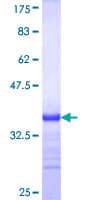 Human NAGPA Protein (Recombinant GST, N-terminus)