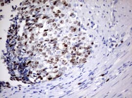 Monoclonal Mouse anti-Human MKI67 / Ki67 Antibody (clone OTI7G8, aa1160-1493, IHC)