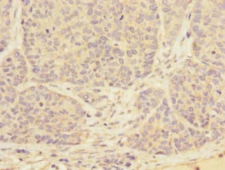 TPM4 Antibody