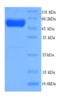 Zebrafish D2HGDH Protein (Recombinant His)