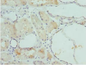 Polyclonal Rabbit anti-Human FBP1 Antibody (IHC)