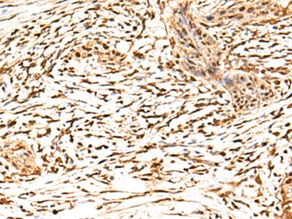 FAM134B Antibody