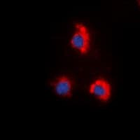 ZAP70 Antibody (phospho-Tyr319)