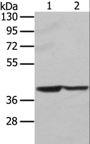 STX16 / Syntaxin 16 Antibody
