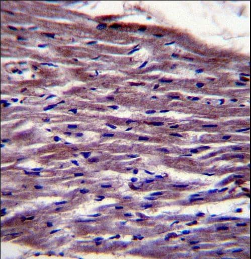 Polyclonal Rabbit anti-Human UNC45B Antibody (aa235-264, IHC, WB)