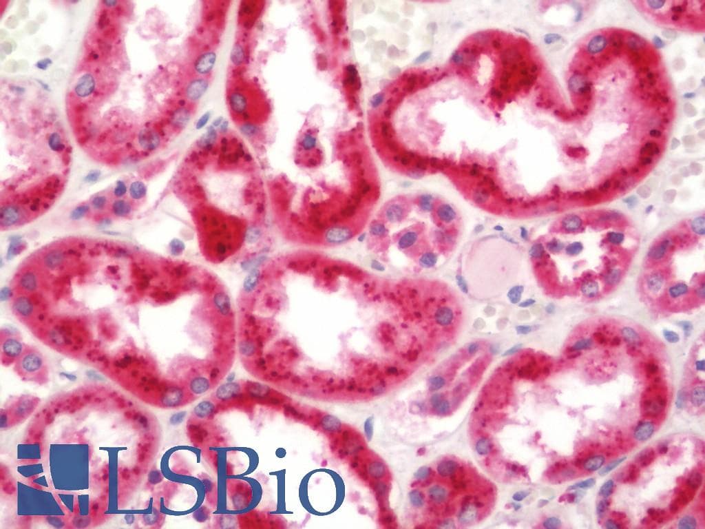 GALNS / Chondroitinase Antibody (Biotin)