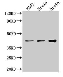 Polyclonal Rabbit anti-Human VPS26B Antibody