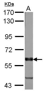 Polyclonal Rabbit anti-Human PALS2 / MPP6 Antibody (aa1-44, IHC, WB)