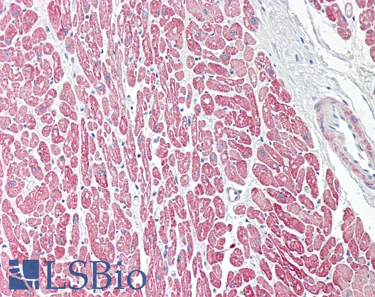 IHC-plus™ Polyclonal Rabbit anti-Human TPM3 Antibody (IHC, IF, WB)