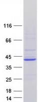 Human ATP6V0D2 Protein (Recombinant Myc-DDK (Flag))