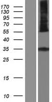 HSD11B1L Protein (Over-Expression Lysate Myc-DDK (Flag))