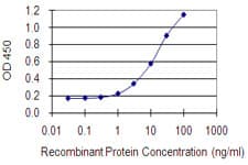 DLST / E2 Antibody (clone 4D7)