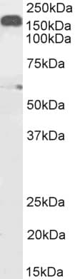 IHC-plus™ Polyclonal Goat anti-Human DCTN1 / Dynactin 1 Antibody (aa1266-1278, IHC, IF, WB)
