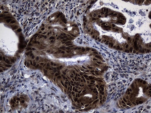DNAJB6 Antibody (clone OTI5B5)