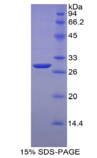 Mouse MYH4 Protein (Recombinant His)