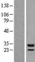 PSMB7 Protein (Over-Expression Lysate Myc-DDK (Flag))