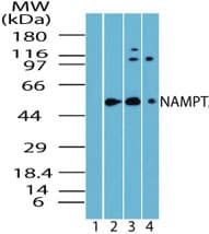 IHC-plus™ NAMPT / Visfatin Antibody (aa30-80)