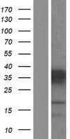 PHOX2A Protein (Over-Expression Lysate Myc-DDK (Flag))