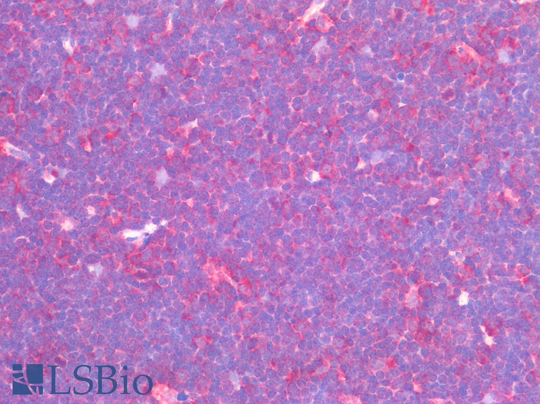 IHC-plus™ Monoclonal Mouse anti-Human Ribosomal protein S27 (metallopanstimulin 1) (RPS27) Antibody (clone 4A12, IHC)