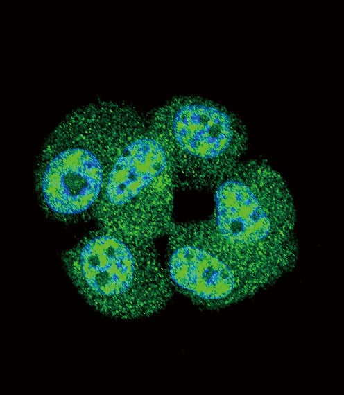 AKT1 Antibody (aa428-457)