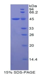 Human Alpha-1-Antichymotrypsin Protein (Recombinant His-GST)