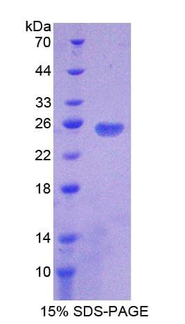 Mouse PD-L2 / PDCD1LG2 / CD273 Protein (Recombinant His-T7)