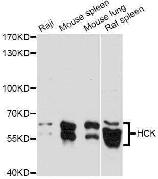 Polyclonal Rabbit anti-Human HCK Antibody (WB)