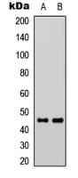 PROKR1 Antibody (N-Terminus)