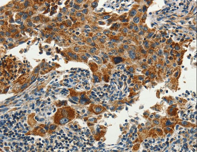 SERPINA9 Antibody