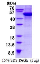 Human CYTH2 / Cytohesin 2 Protein (Recombinant His)