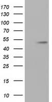 TUBA8 / Tubulin Alpha 8 Antibody (clone OTI2C2)