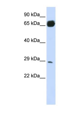 Polyclonal Rabbit anti-Human PRTFDC1 / HHGP Antibody (N-Terminus, WB)