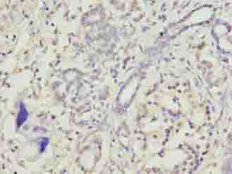 TRAM2 Antibody