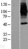 Human SLC11A2 / DMT1 Protein (Over-Expression Lysate Myc-DDK (Flag))