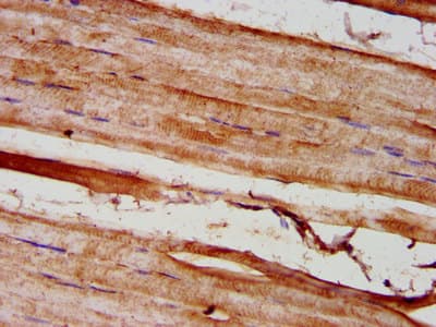 GREM1 / Gremlin-1 Antibody