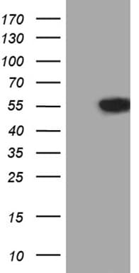 VRK2 Antibody (aa301-486, clone OTI2A2)