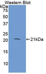 STMN1 / Stathmin / LAG Antibody (aa2-149, PE)