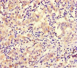 SMARCE1 / BAF57 Antibody