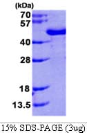 Human NAT6 / FUS2 Protein (Recombinant His)