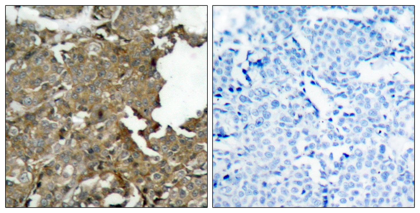 CFL1 / Cofilin Antibody (p3)