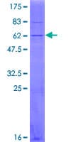 Human SLC25A6 / ANT3 Protein (Recombinant GST)